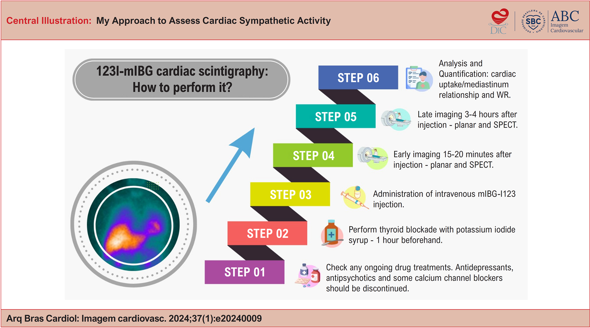 My Approach to Assess Cardiac Sympathetic Activity